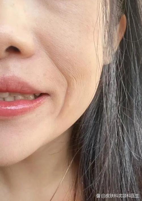 笑紋是什么 有笑紋的女人面相分析