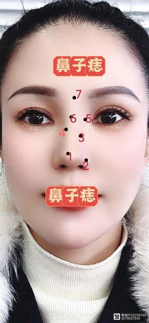 鼻子有痣雖美但不吉