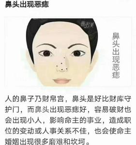 女人右鼻翼有痣好不好