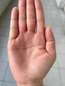 斷掌紋的男人