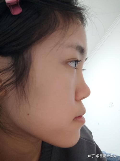 塌鼻子的人都很窮嗎