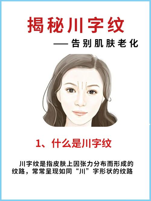 為什么突然有了川字紋