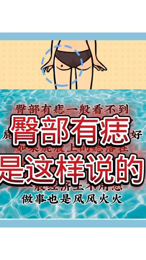 痣相解析臀部上長痣，意味著什么？