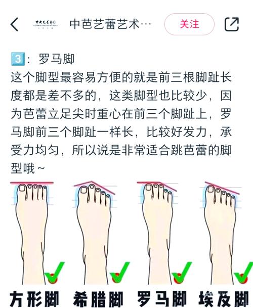 女人羅馬腳有什么說(shuō)法