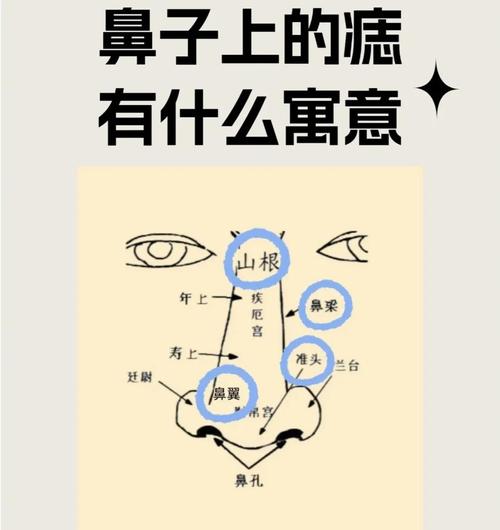 鼻梁中間有痣代表什么 男人鼻梁上有痣代表什么