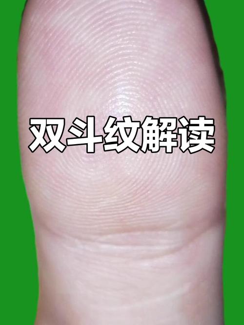 雙斗紋性格 雙斗紋命運(yùn)