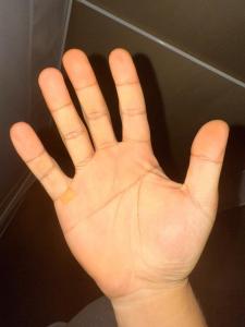 兩只手都是斷手掌紋的男孩命運(yùn) 兩個(gè)手都是斷掌的男人