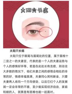 太陽穴長痣有什么含義？
