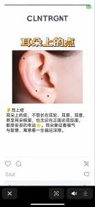 耳朵里長黑痣代表什么