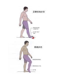 怎么從走路姿勢看富貴貧窮