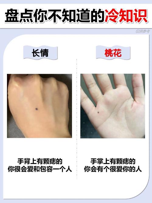 手背上有痣代表什么