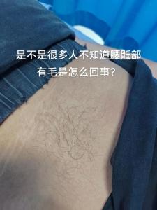 身體這些地方長(zhǎng)毛有福氣