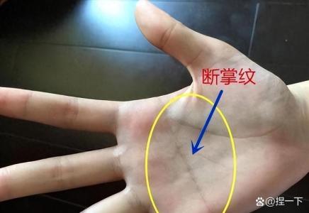 男人右手斷掌克什么嗎